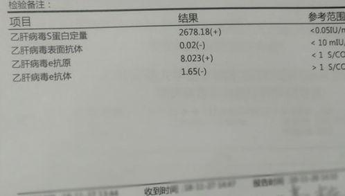 肝素结合蛋白测定91正常吗,肝素结合蛋白测定91正常范围分析